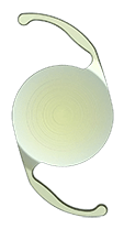AcrySof_IQ_Single_Light_Natural113 AcrySof_IQ_Single_Light_Natural113