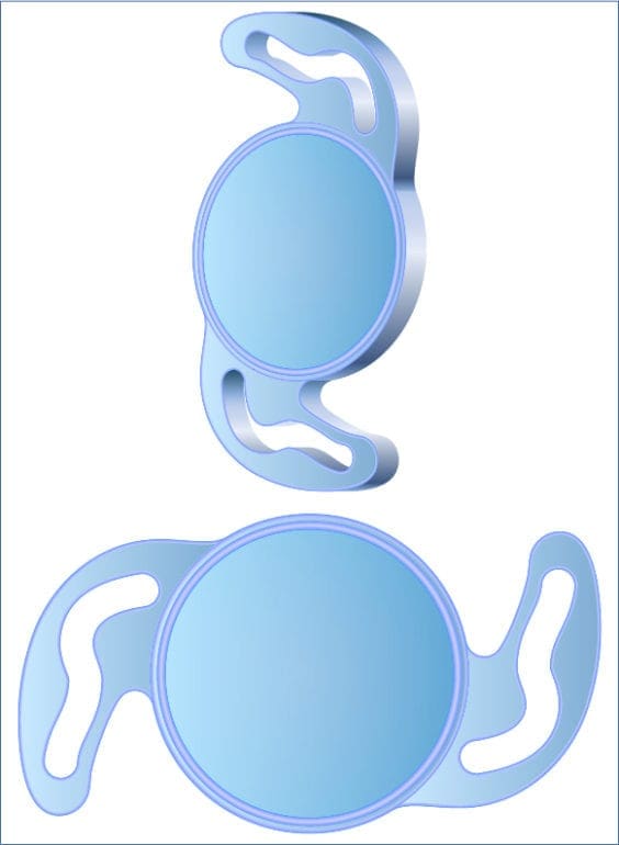 Panoptix иол. Хрусталик acrysof iq. Линзы acrysof iq sn60wf. Иол офтальмология алкон. Хрусталик acrysof iq.