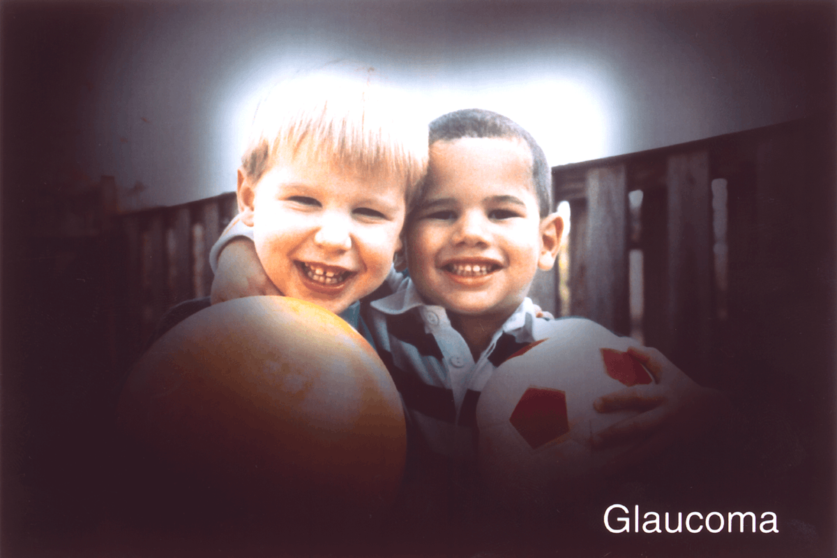Glaucoma Eyesight