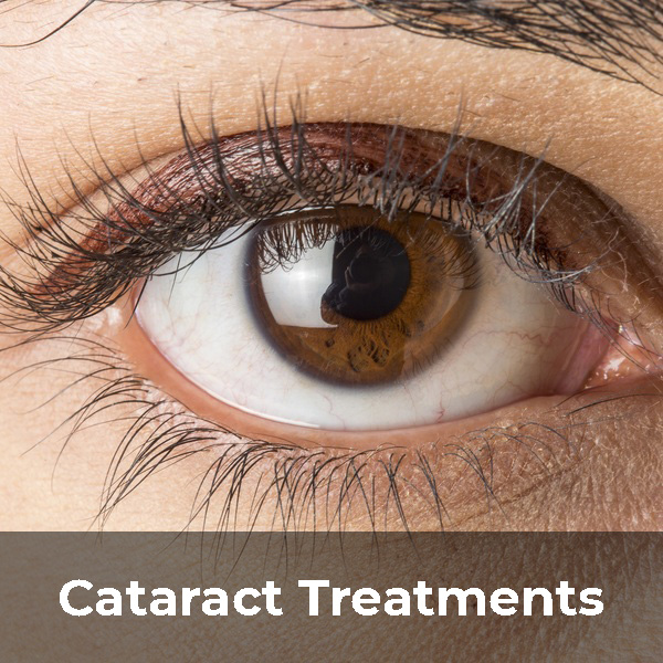 Cataract Treatment Navigation
