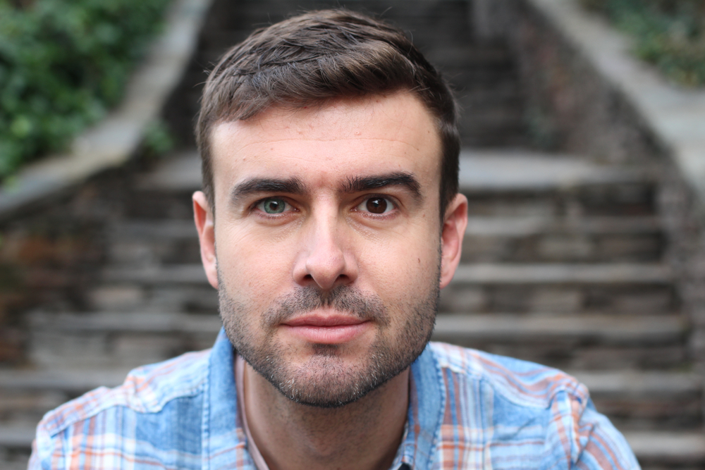 Man with heterochromia.(Two colored eyes)