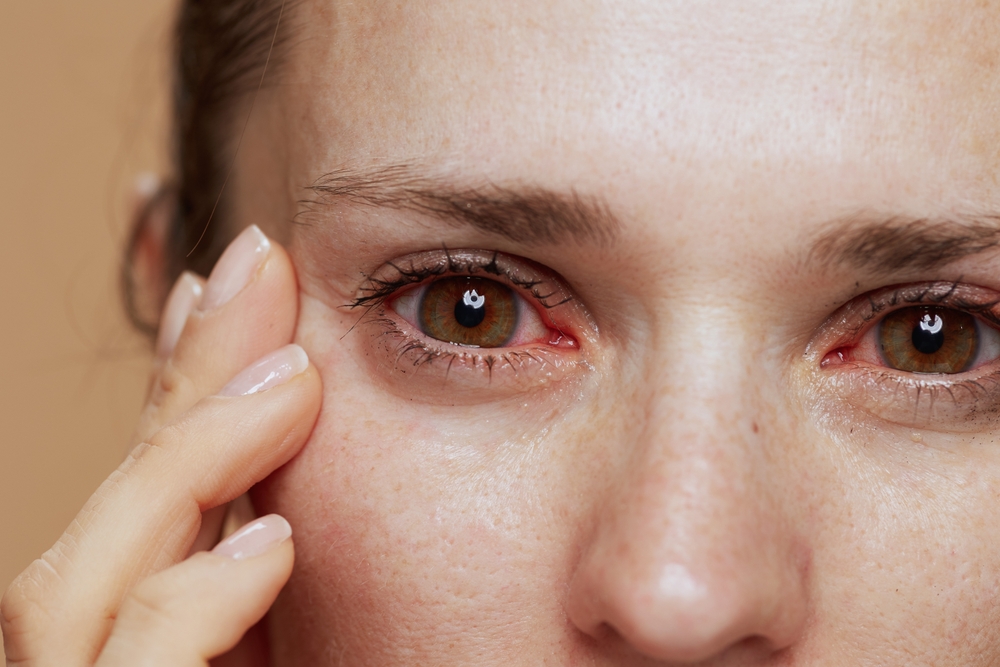 Common Causes of Dry Eye