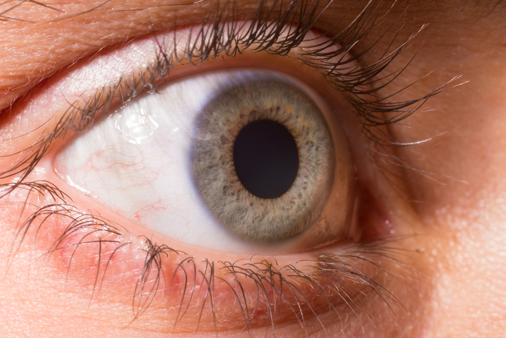 Dilated Pupils